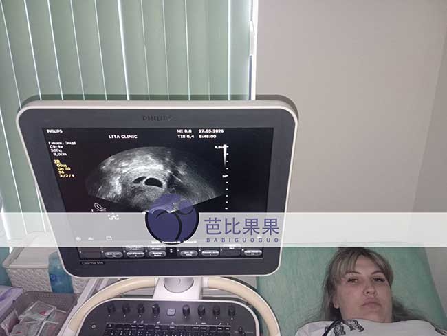 乌克兰试管二胎案例传来喜讯,首次B超确认宫内双胞胎