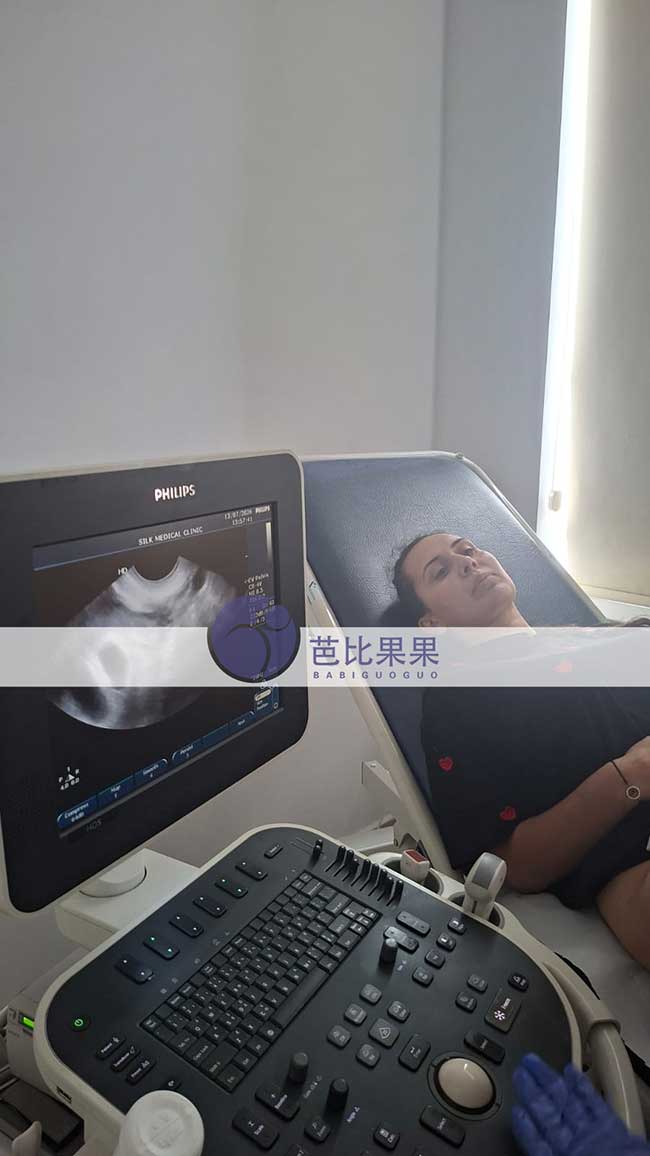 经历多次试管失败后,苏女士到格鲁吉亚试管孕育新进展