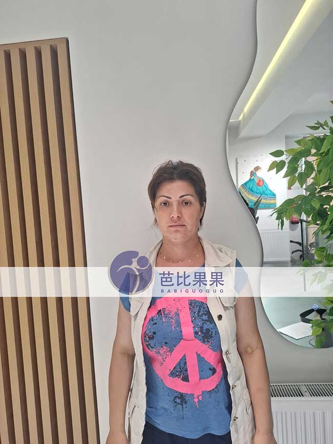 从一枚健康胚胎到一颗跳动的胎心,杨先生在格鲁吉亚试管孕7周好消息