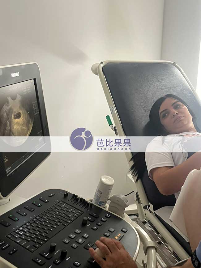 一张B超照片,记录孔女士家庭在格鲁吉亚试管路上的新一步