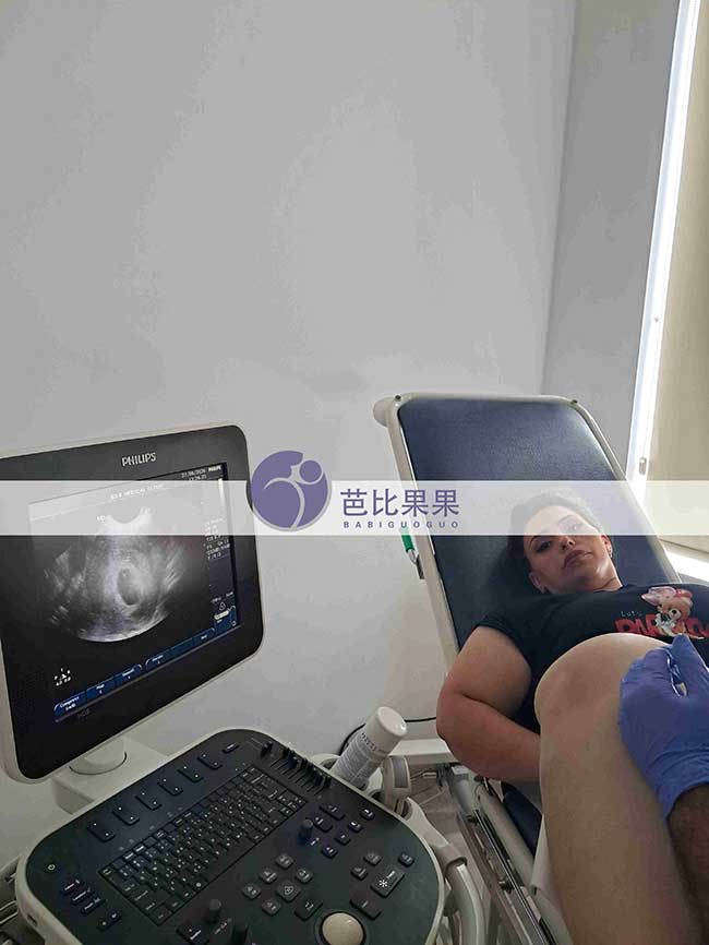 经历长期尝试后,梁女士终于在格鲁吉亚试管旅程中看到第一次胎心