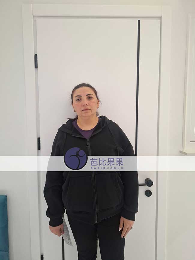 两份孕8周B超记录,见证黎先生与任先生的格鲁吉亚试管新进展