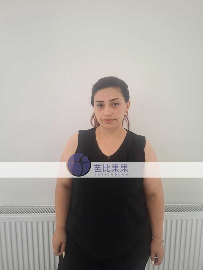 一份刚过NT关,一份迈入孕16周|格鲁吉亚试管两个家庭的孕期记录