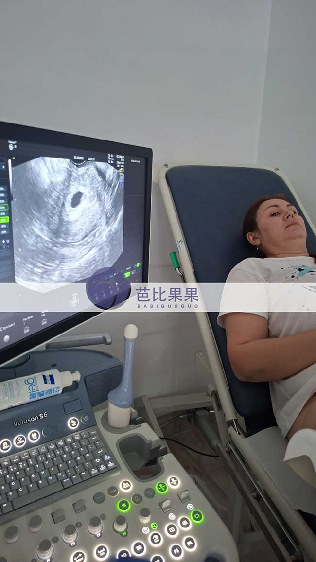 第一次B超迎来关键进展:赵先生的格鲁吉亚试管案例确认宫内妊娠
