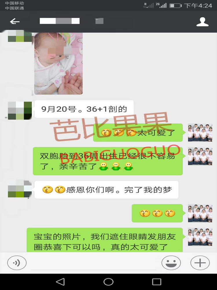 36周顺利生下健康双胞胎