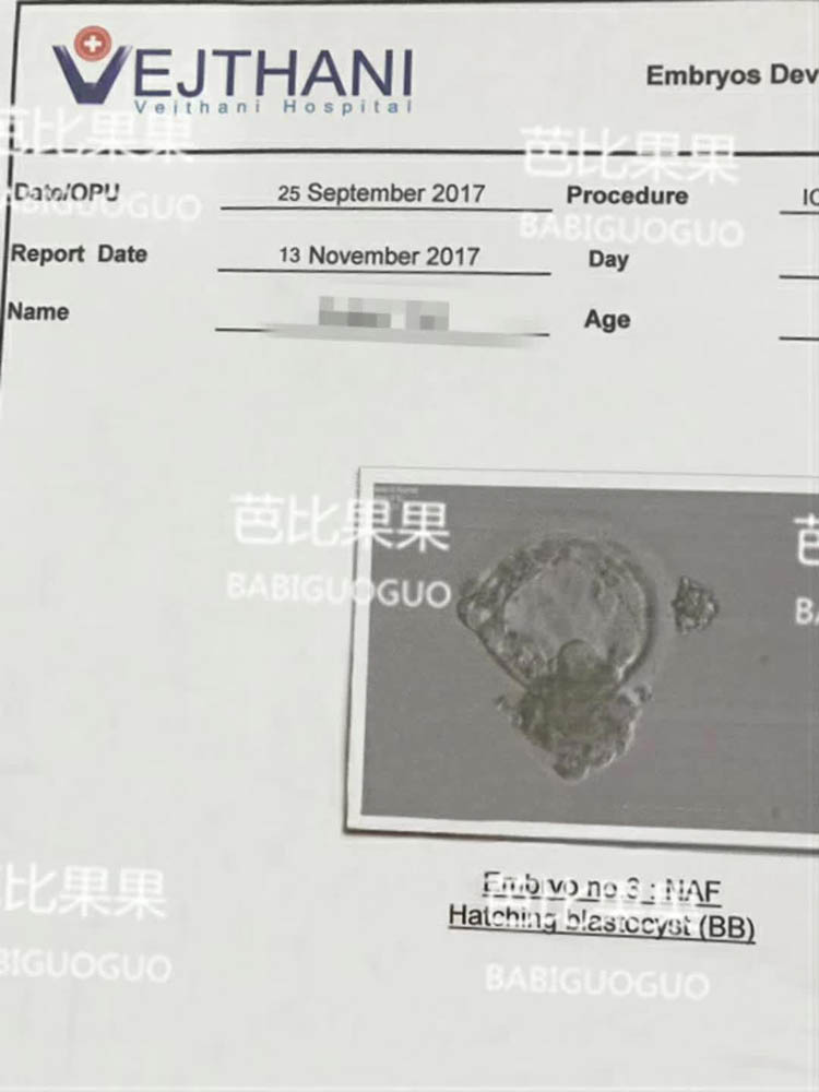 客户在泰国威他尼试管婴儿医院顺利移植胚胎