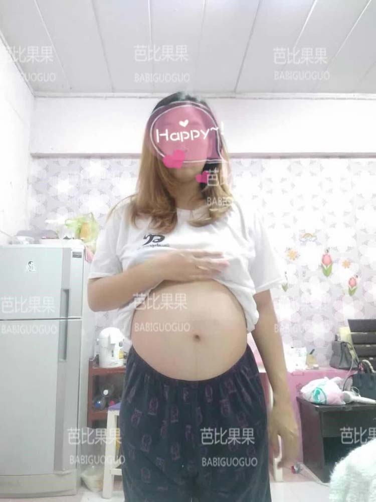 H姐的泰国试管婴儿SM28周的检查 B超看胎儿正常