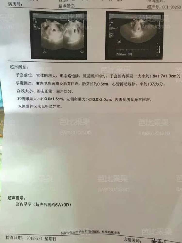 试管移植后Y姐去医院做了第一次B超 情况很好