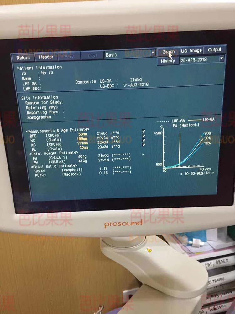 泰国试管爱心孕21周做B超看宝宝指标
