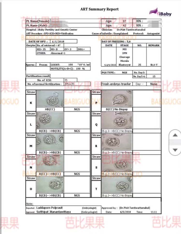 泰国试管婴儿囊胚