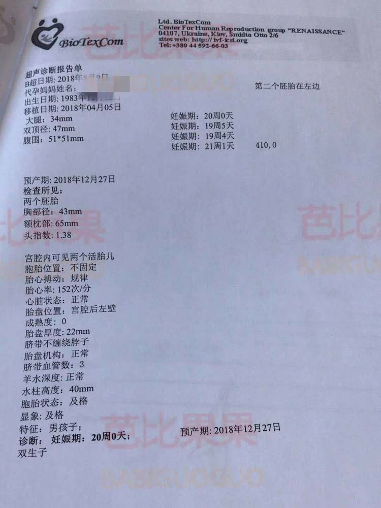 乌克兰爱心妈妈怀双胞胎男宝